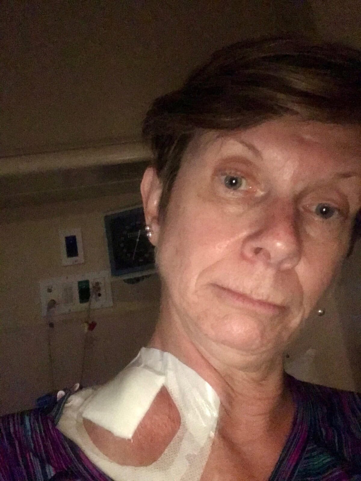 A person with short hair and a neutral expression shows a bandaged area with medical tape on their upper chest and shoulder, likely in a hospital setting.
